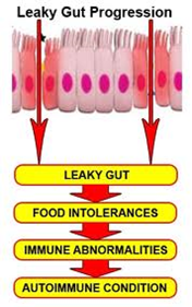 What is IBS?